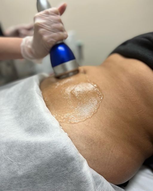 Slimming & Cellulite