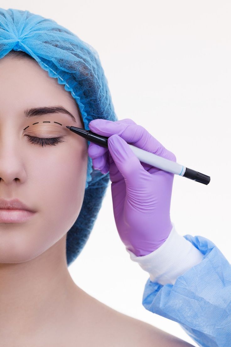 Non-surgical Blepharoplasty