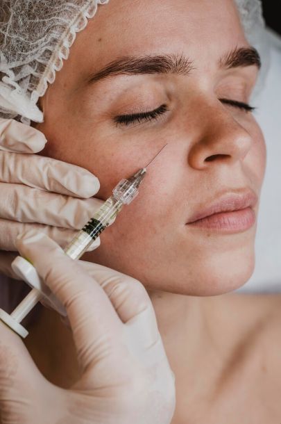 Dark Circles – Filler / PRP