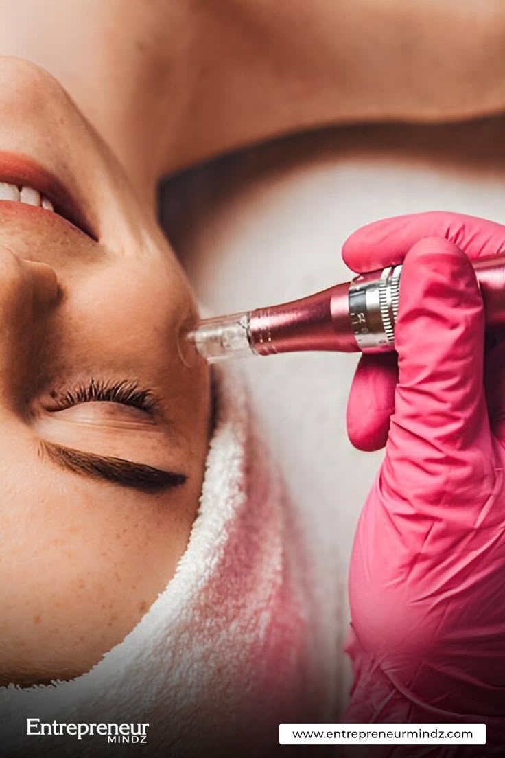 Microneedling