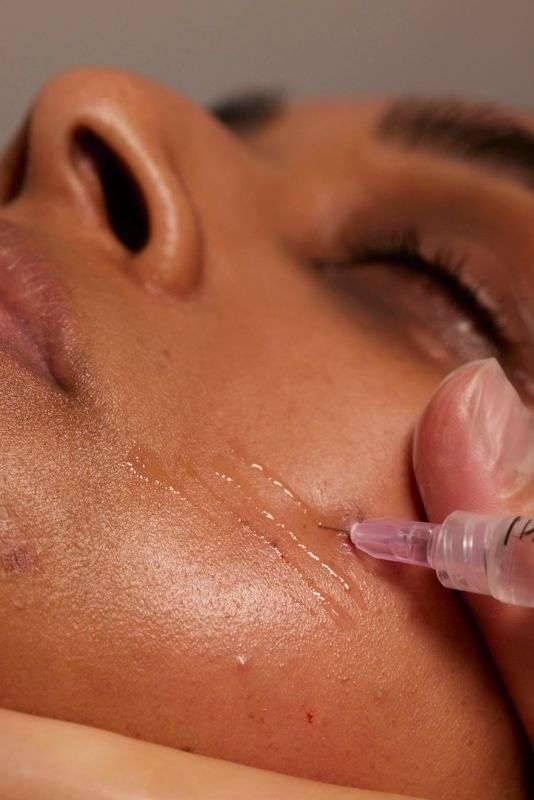 Skinbooster / Profhilo